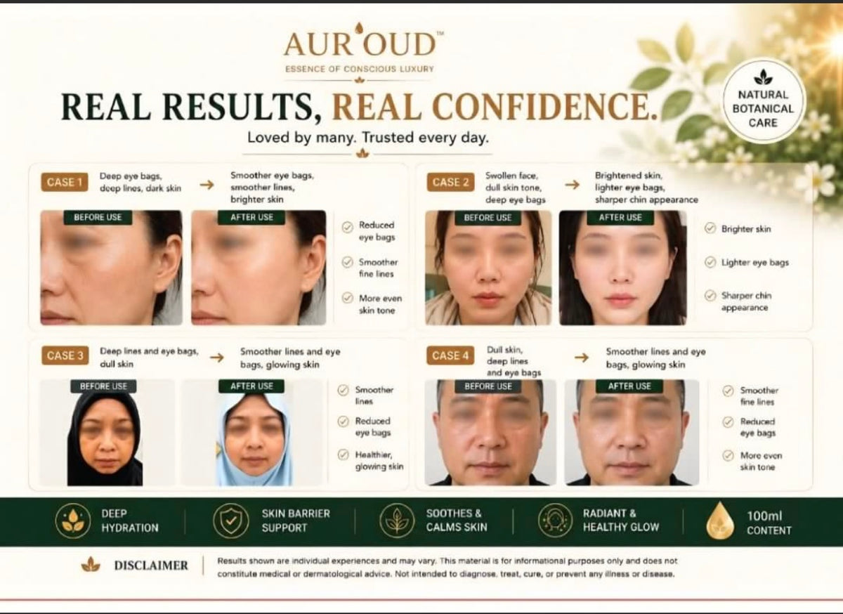 Aur'OUD Anti-Wrinkle Moisturizing Serum (Natural Agarwood OUD) and Spray Mist